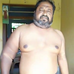 Biju George, Dialysis Patient